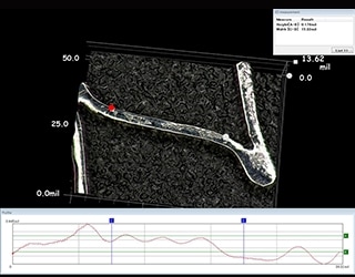 Bioabsorbable stent 3D shape and profile measurement